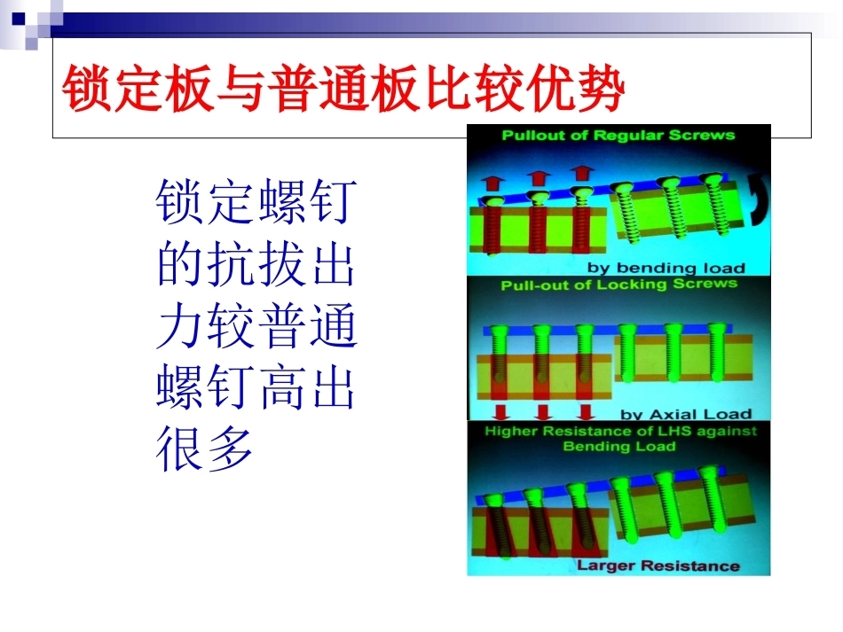 锁定钢板的应用及注意 事项_第10页