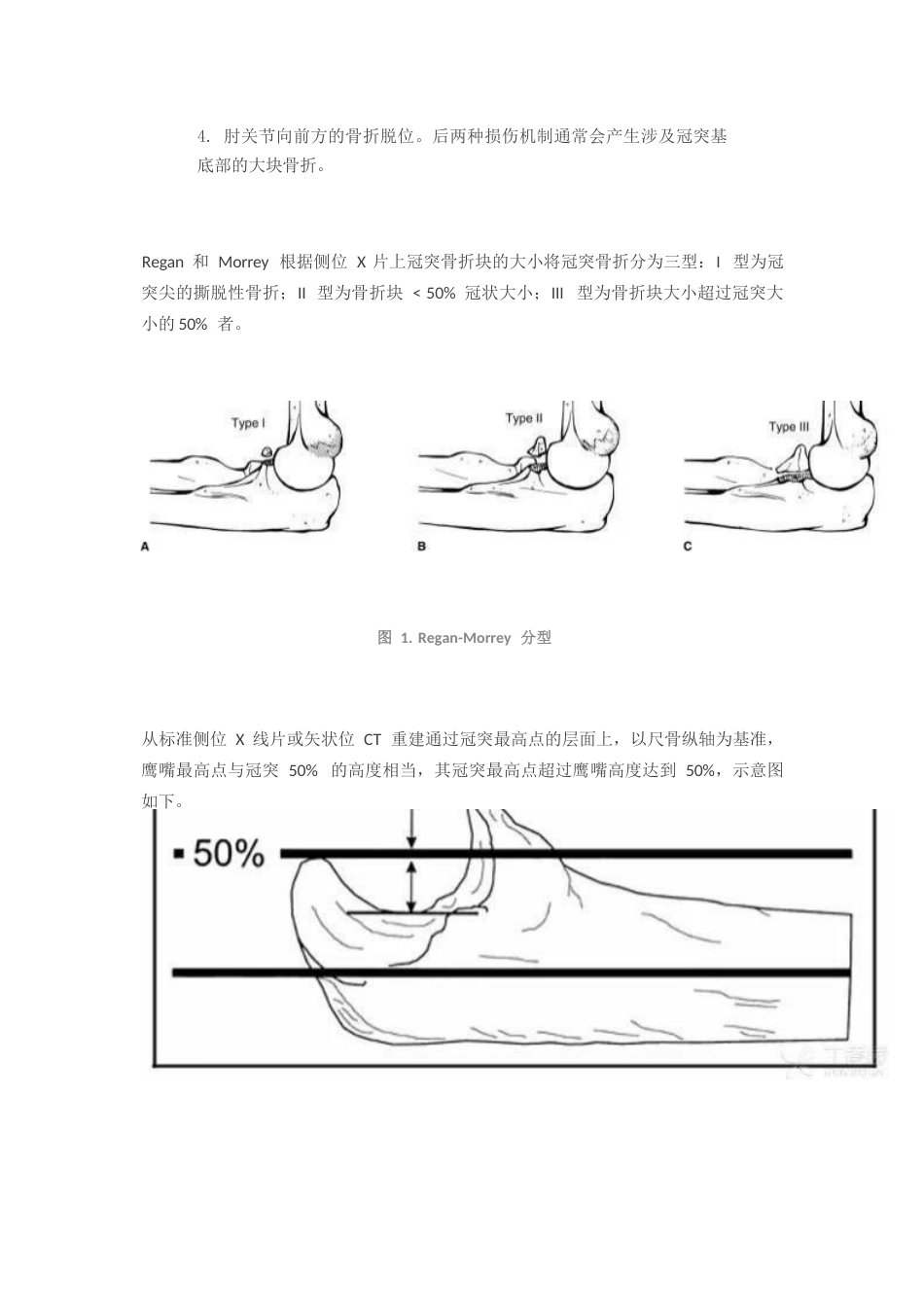 尺骨冠突骨折分型_第2页