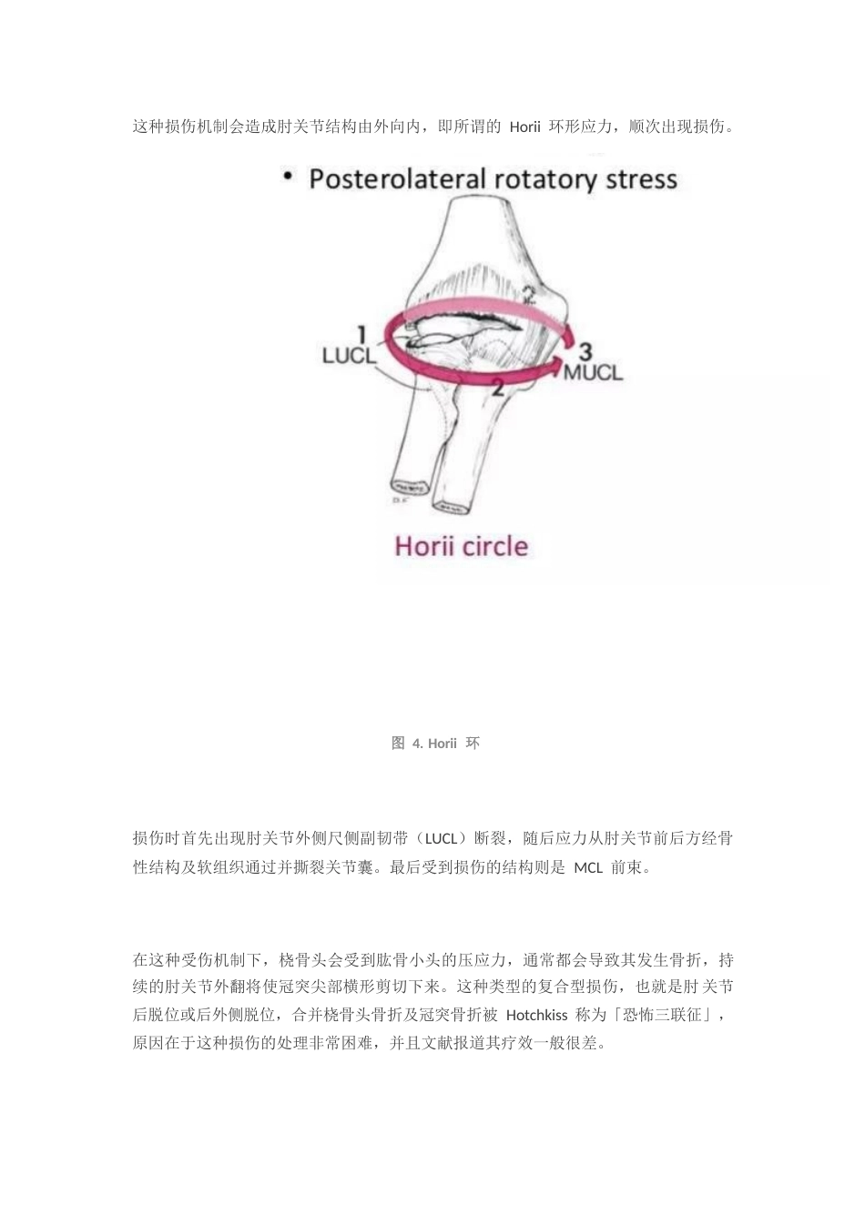 尺骨冠突骨折分型_第4页