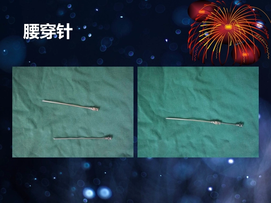 髌骨骨折的微创治疗_第11页
