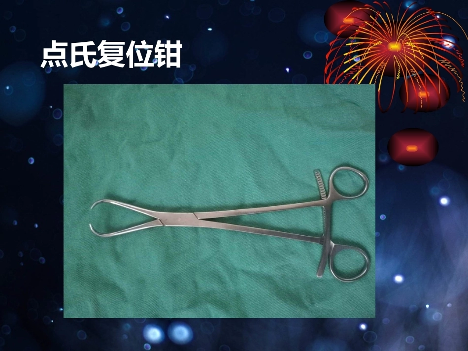 髌骨骨折的微创治疗_第12页