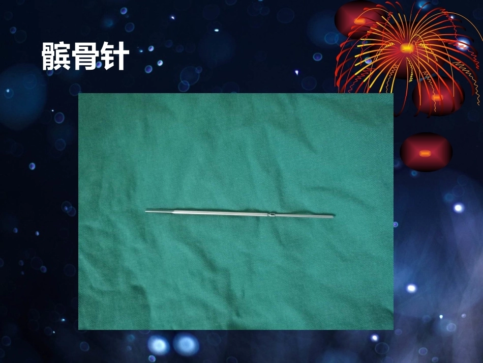 髌骨骨折的微创治疗_第13页