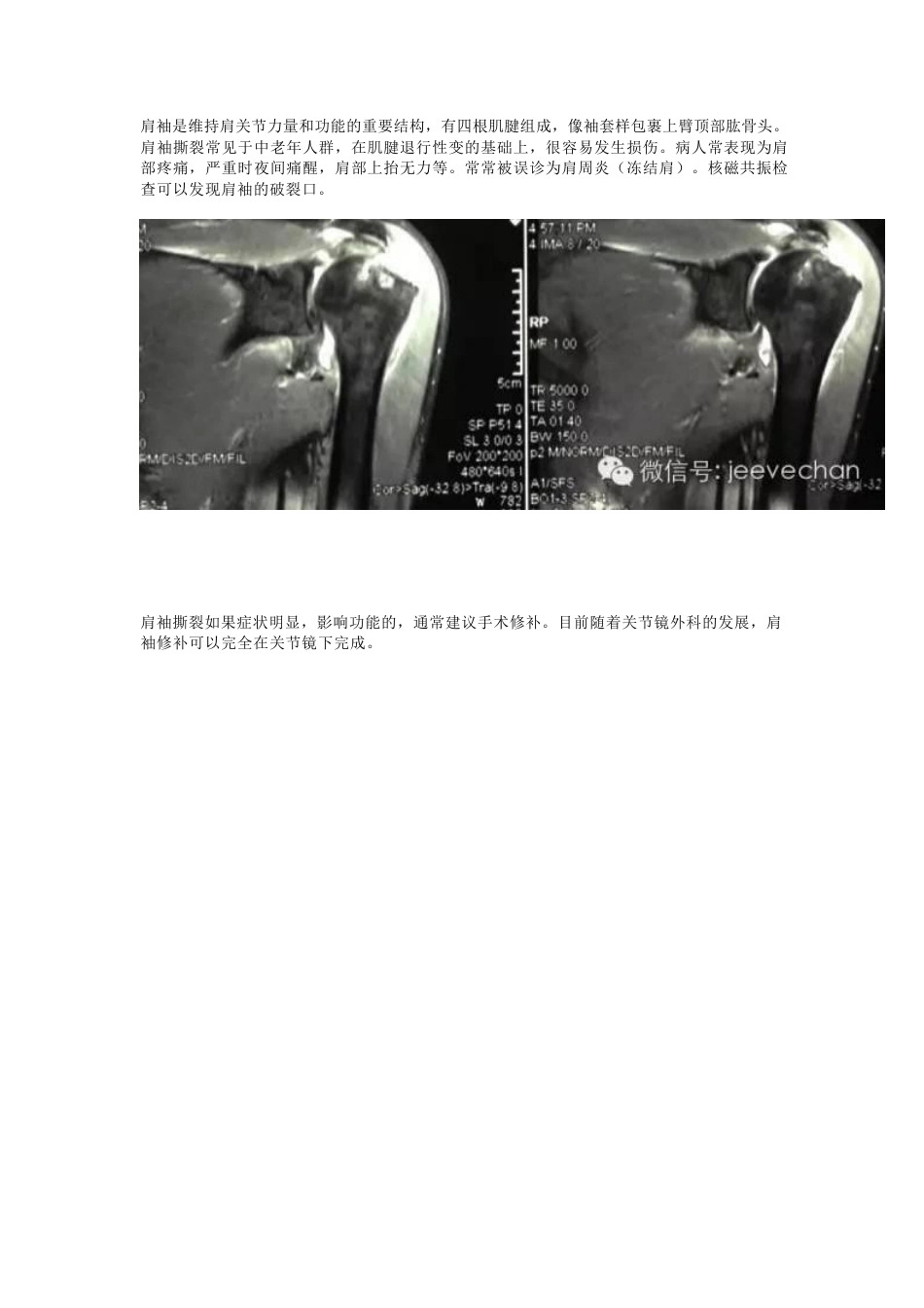 关节镜下肩袖修补的手 术技巧_第1页