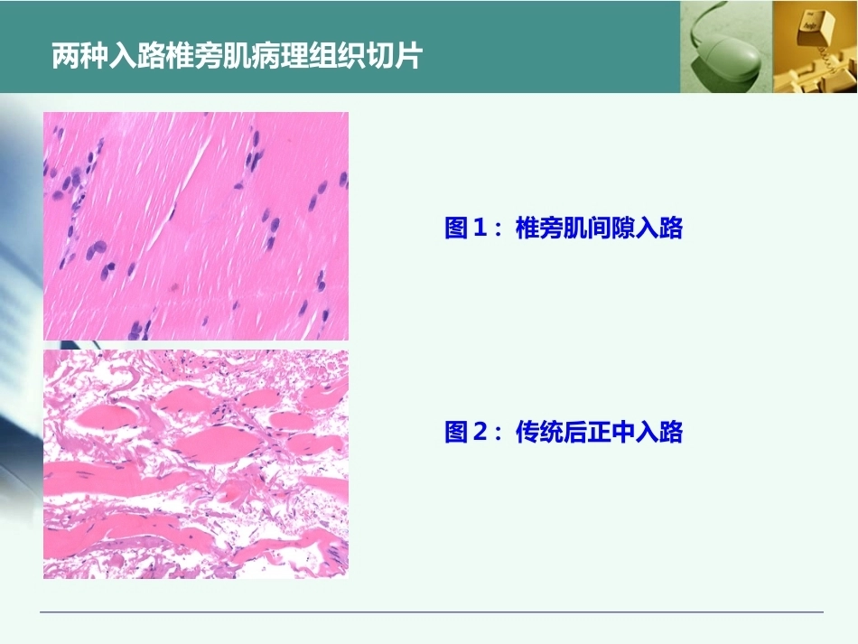 全胸腰椎椎弓根置钉技术_第11页