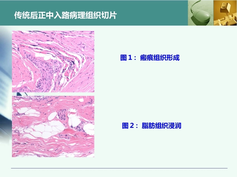 全胸腰椎椎弓根置钉技术_第12页