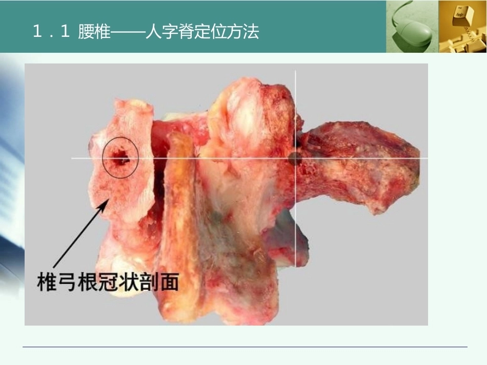 全胸腰椎椎弓根置钉技术_第15页