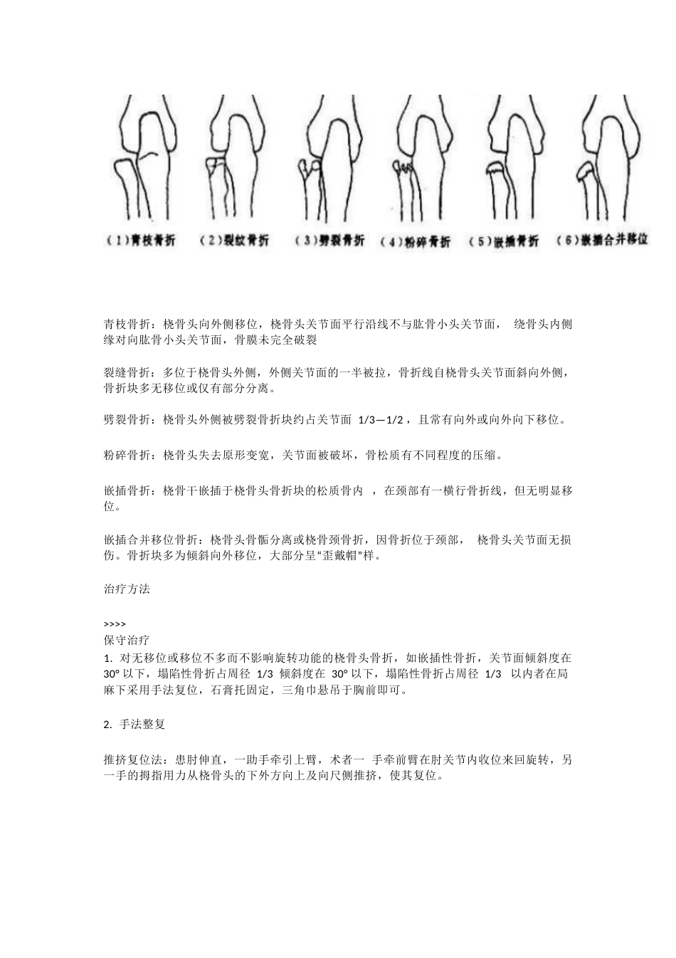 桡骨头骨折分型_第2页
