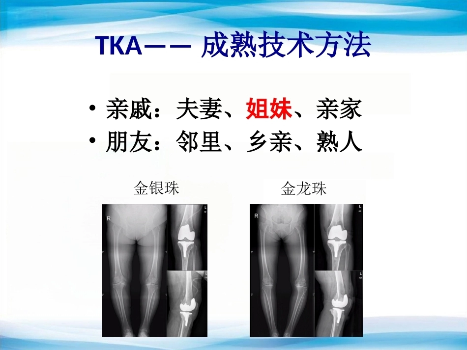 B UKA与TKA 如何选择？_第4页