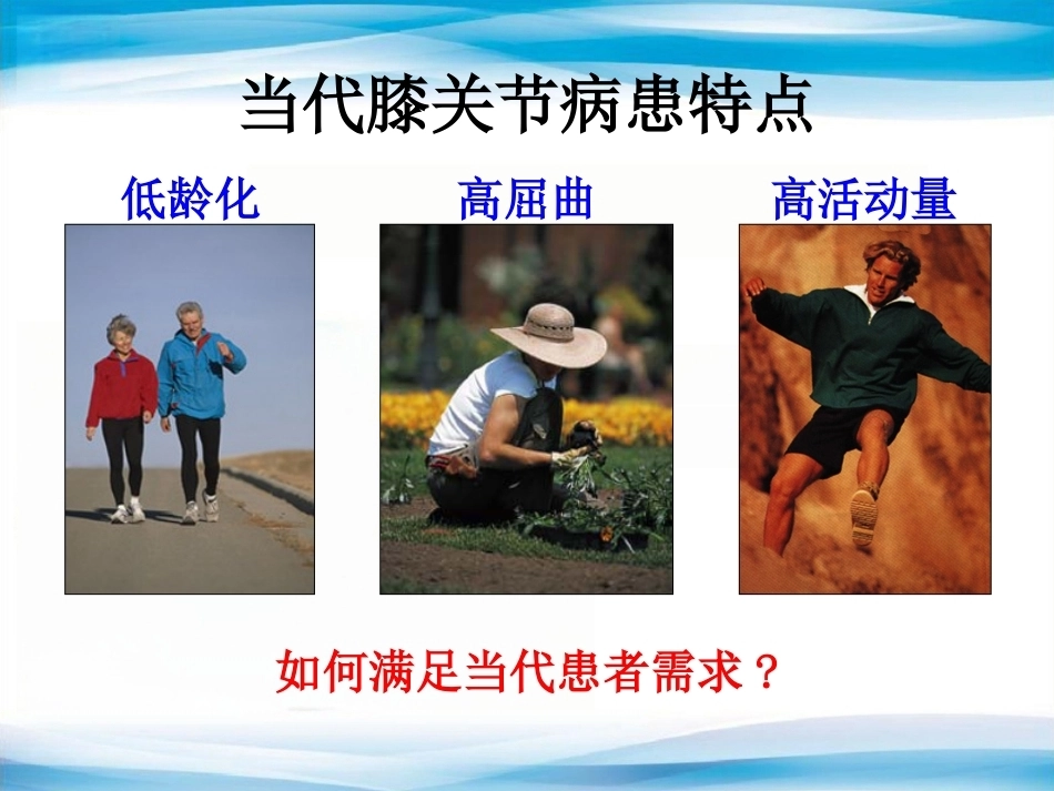 B UKA与TKA 如何选择？_第9页