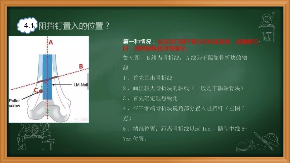 阻挡钉-周迁迁_第11页