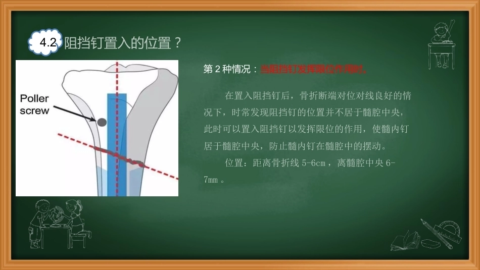 阻挡钉-周迁迁_第12页