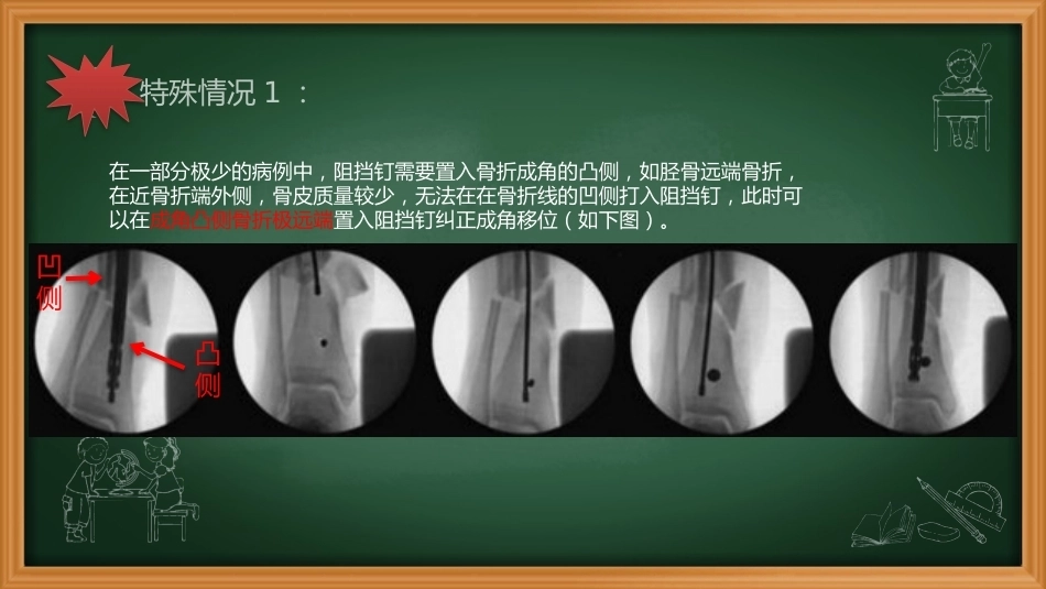阻挡钉-周迁迁_第13页