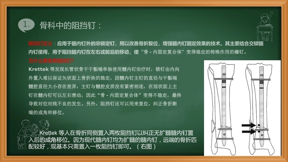 阻挡钉-周迁迁_第4页