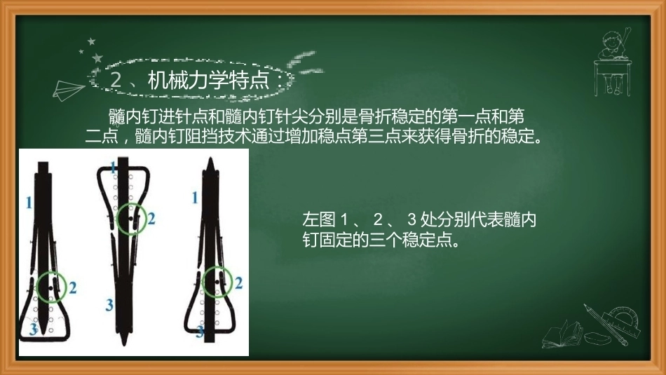 阻挡钉-周迁迁_第5页