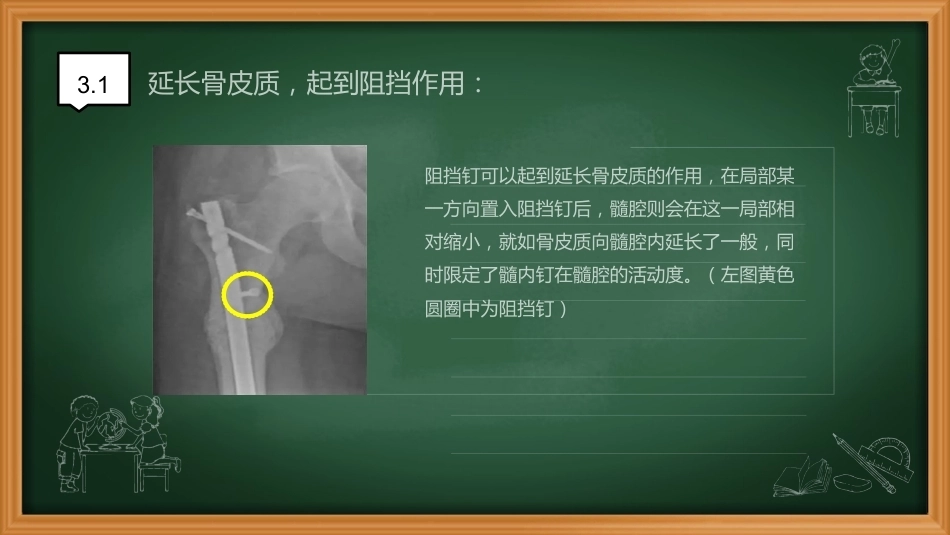 阻挡钉-周迁迁_第7页