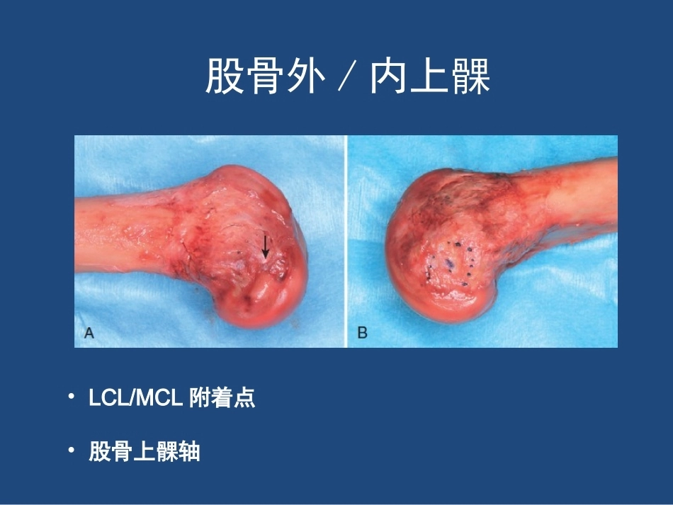 膝关节 解剖详细图解_第14页