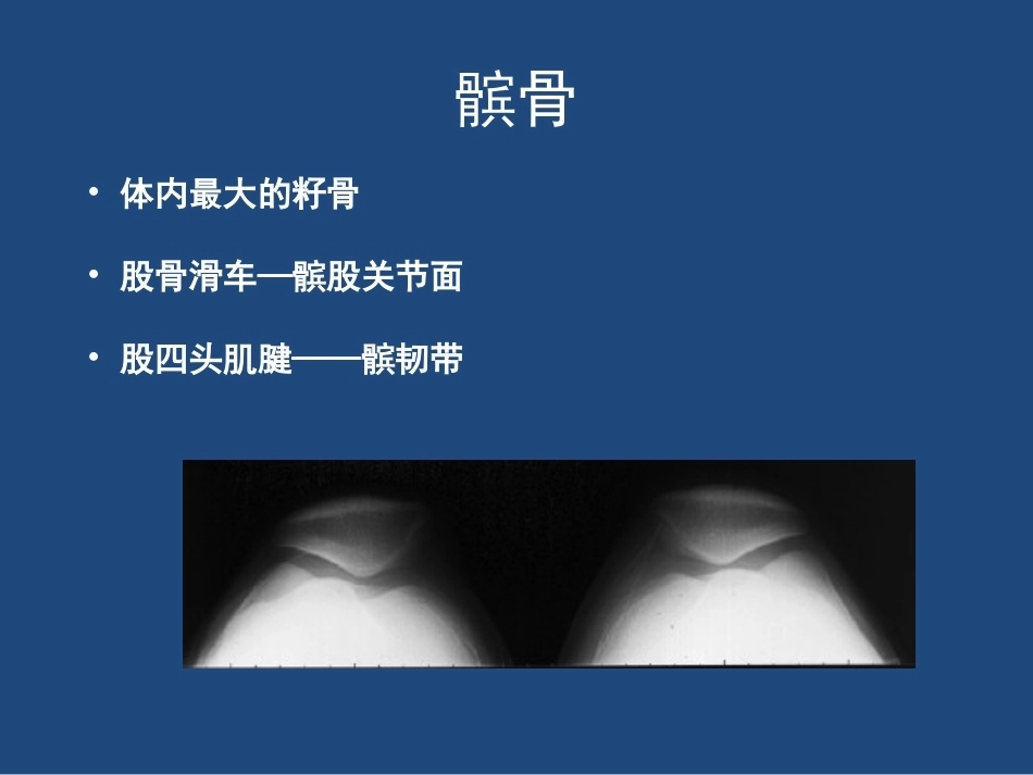 膝关节 解剖详细图解_第6页