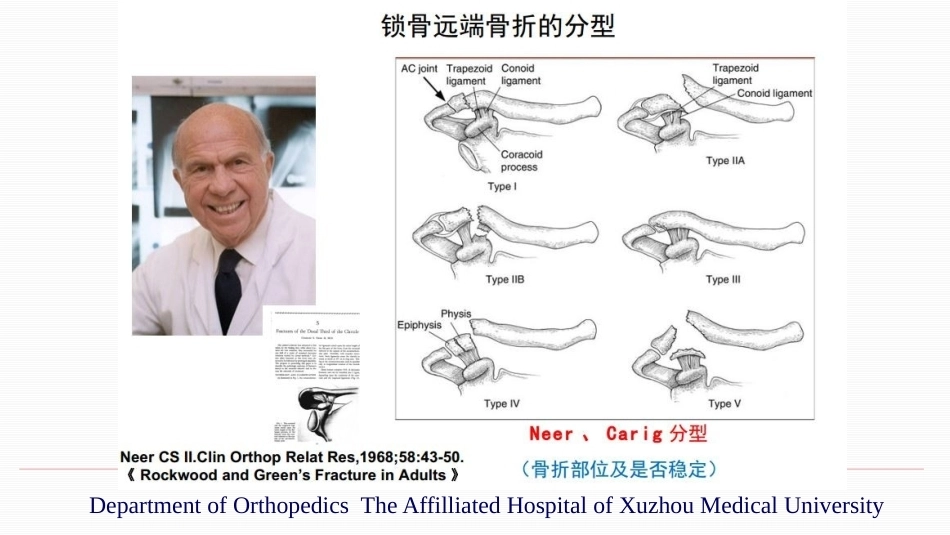 锁骨远端骨折伴肩锁关节脱位的治疗_第7页