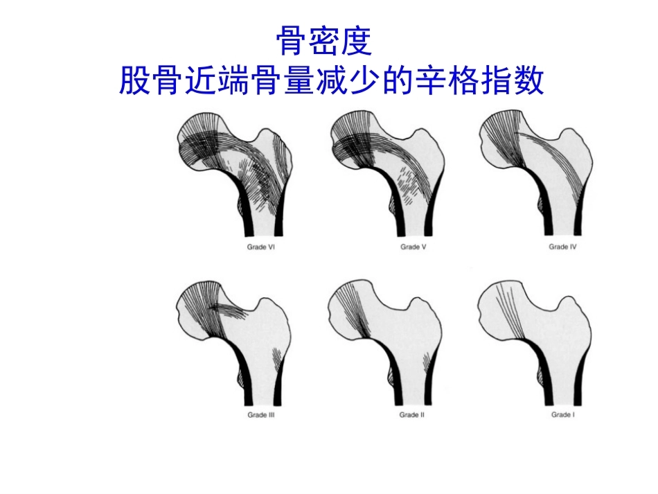 股骨颈骨折的诊断和治疗翻译_第4页
