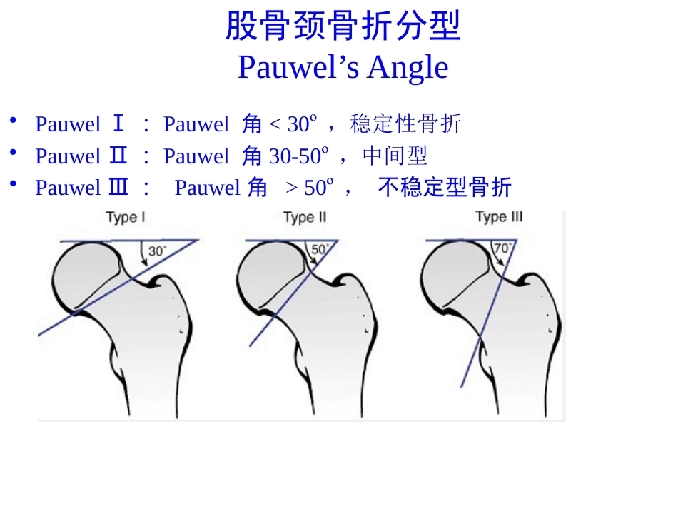 股骨颈骨折的诊断和治疗翻译_第7页