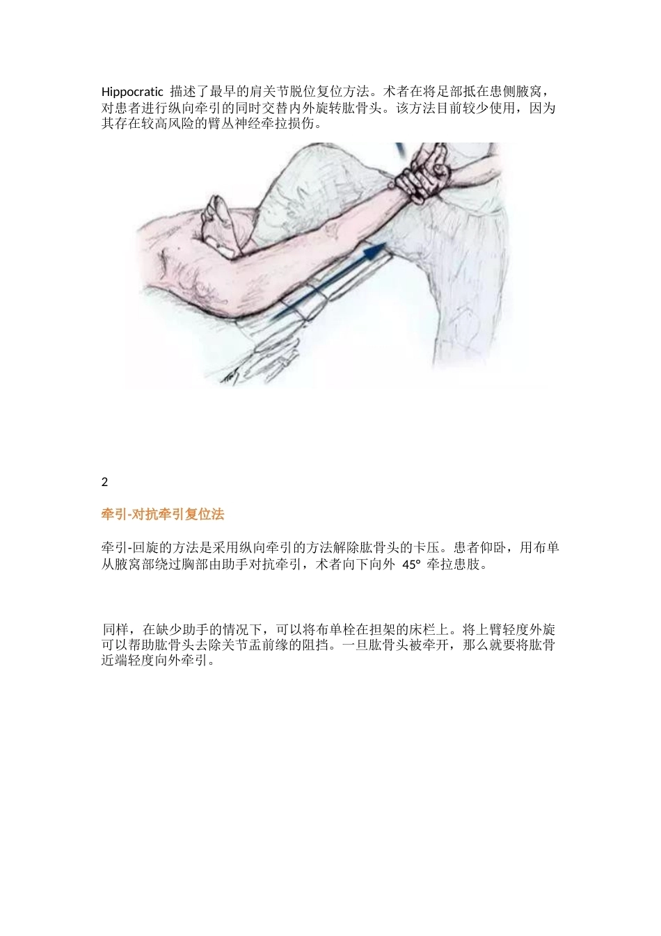 肩关节前脱位的十一种复位方法_第2页