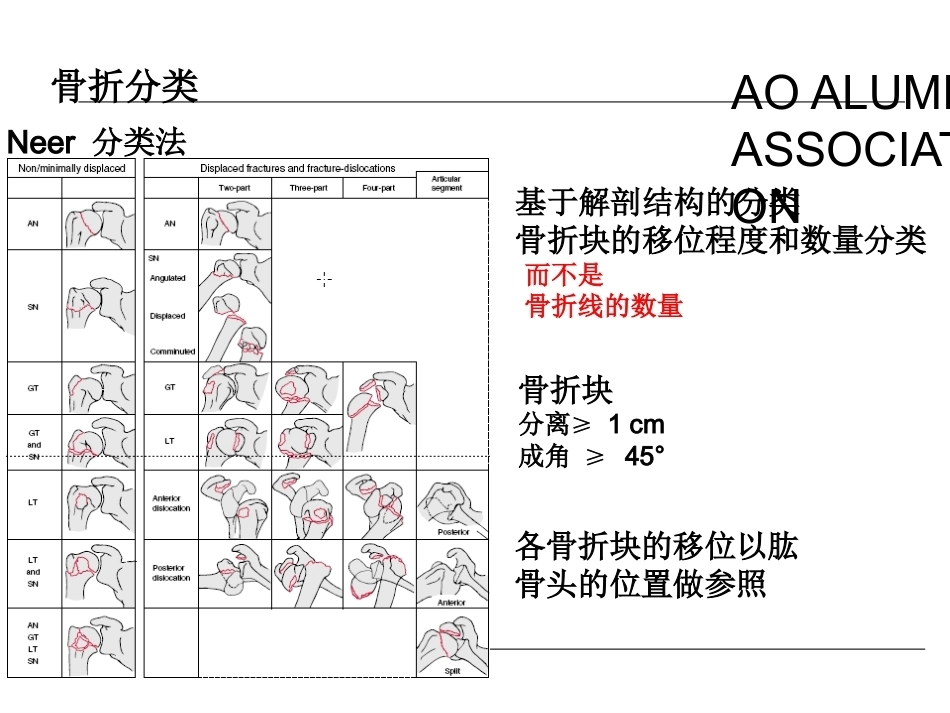 肱骨近端骨折的诊治_第14页
