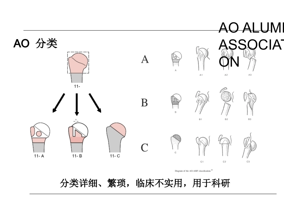 肱骨近端骨折的诊治_第15页