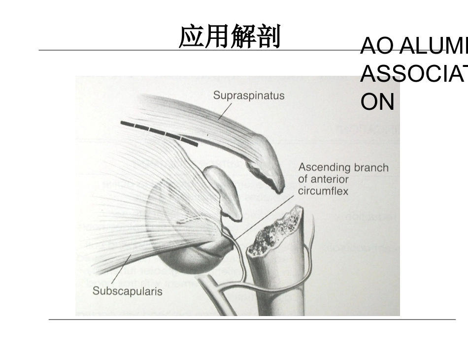 肱骨近端骨折的诊治_第7页