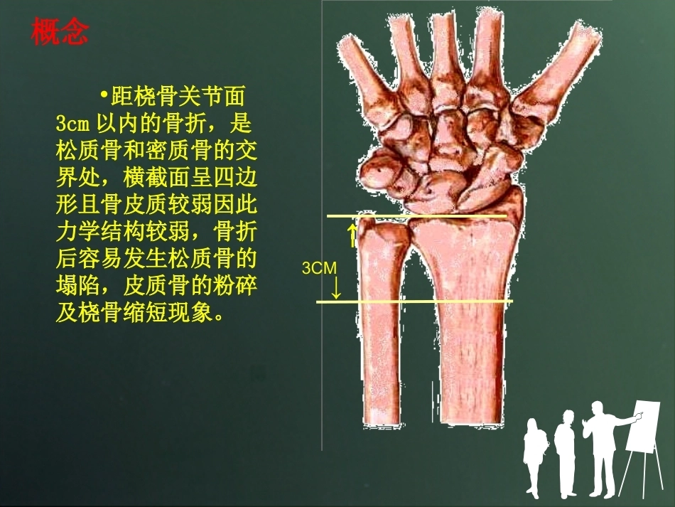 桡骨远端骨折分型_第4页