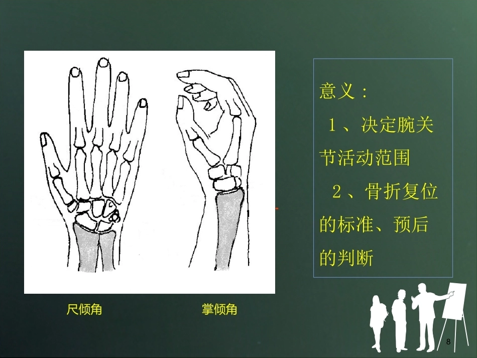 桡骨远端骨折分型_第8页