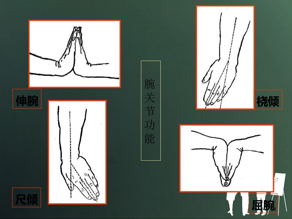 桡骨远端骨折分型_第9页