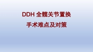 DDH全髋关节置换手术难点及对 策
