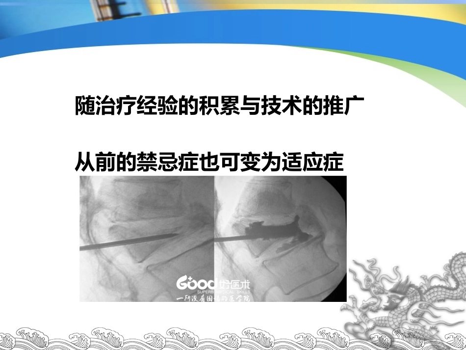 胸腰椎骨折的 微创 手术治疗_第14页