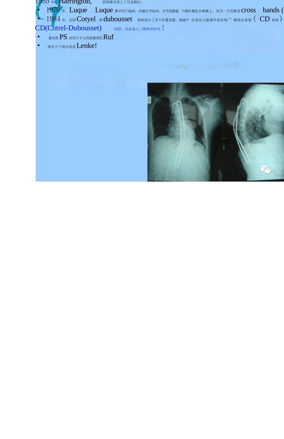 脊柱侧凸的分类和影像分型_第10页