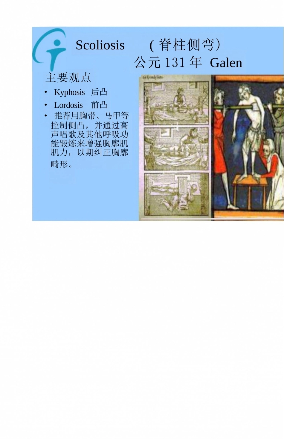 脊柱侧凸的分类和影像分型_第7页