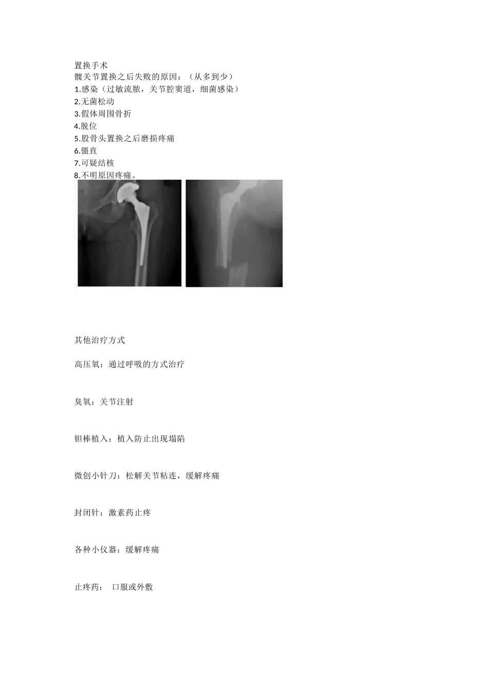 股骨头坏死的诊 断与治疗策略_第12页
