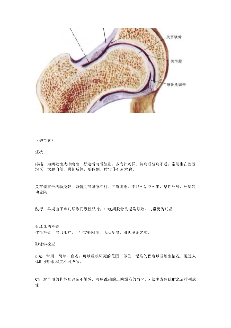 股骨头坏死的诊 断与治疗策略_第4页
