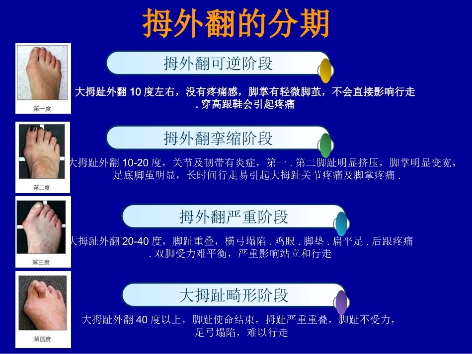 拇外翻的概念与分型_第6页