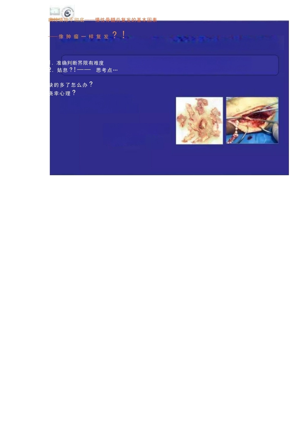 显微技术 治疗骨髓炎骨缺损_第6页