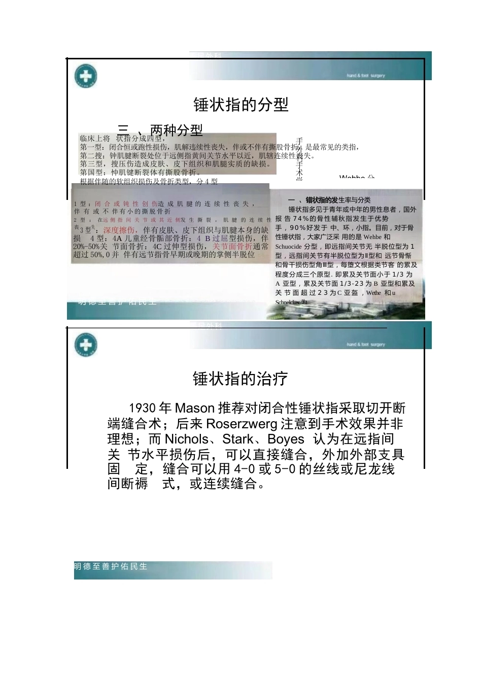 锤状指的分型及手术治疗_第3页