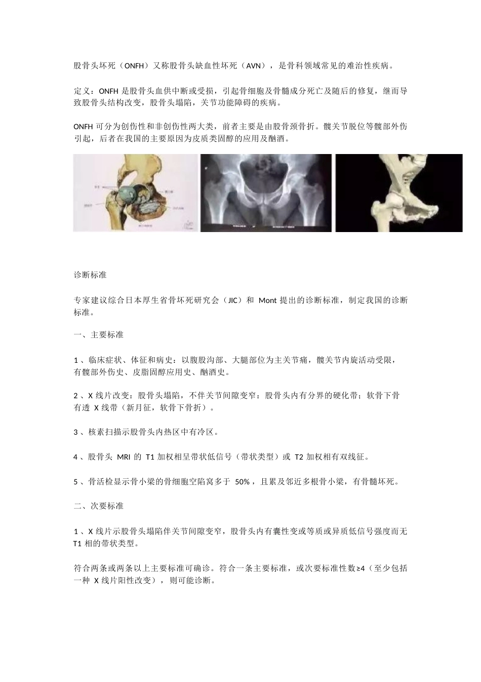 股骨头坏死的分型治疗_第1页