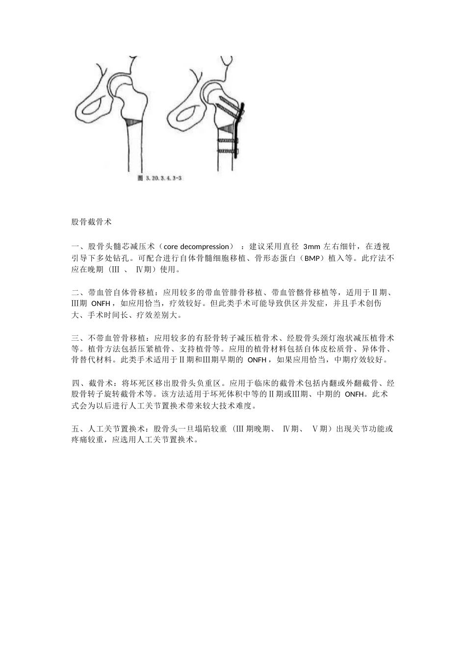 股骨头坏死的分型治疗_第10页