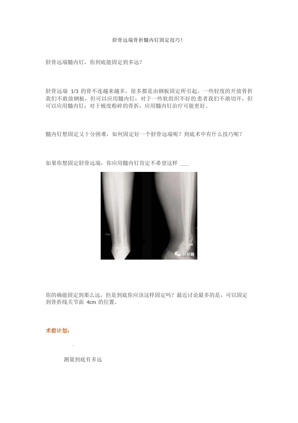 胫骨远端骨折髓内钉固定 技巧_第1页