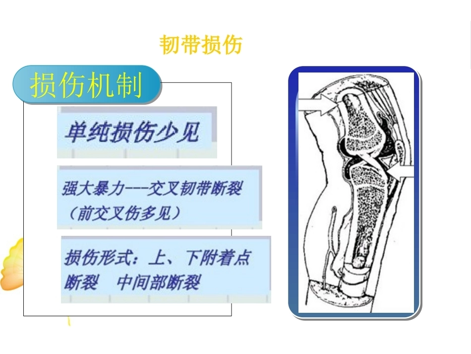 膝关节韧带损伤 的MRI诊断_第3页