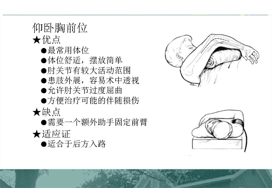肱骨远端C型骨折的手术入路_第13页