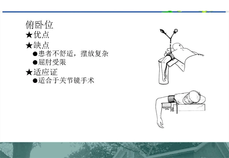 肱骨远端C型骨折的手术入路_第15页