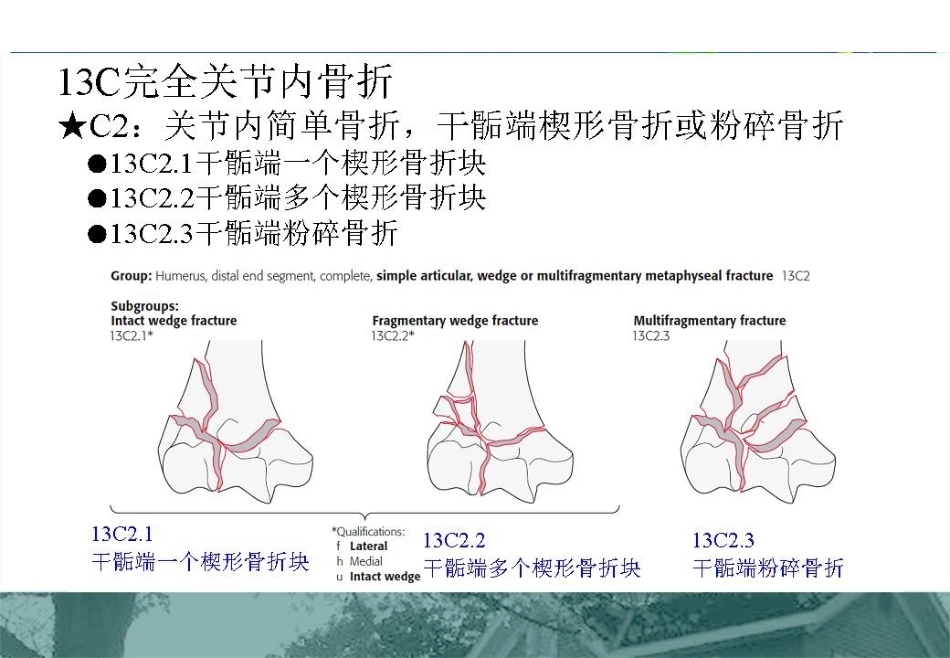 肱骨远端C型骨折的手术入路_第6页