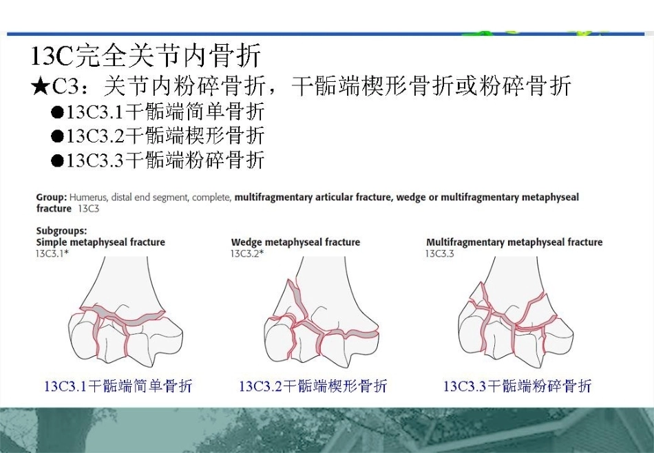 肱骨远端C型骨折的手术入路_第7页