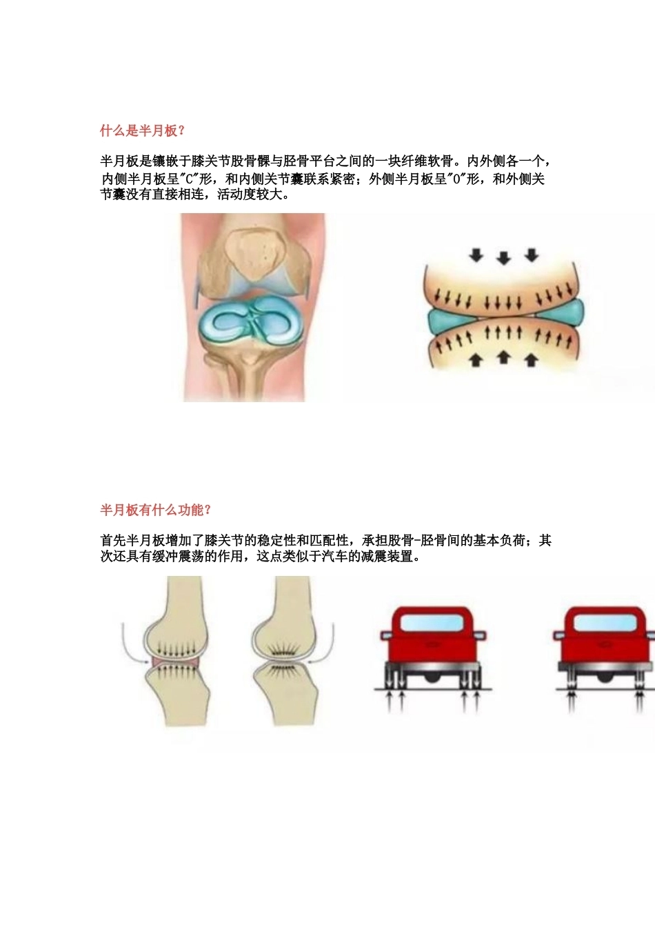 半月板损伤的治 疗技巧_第1页