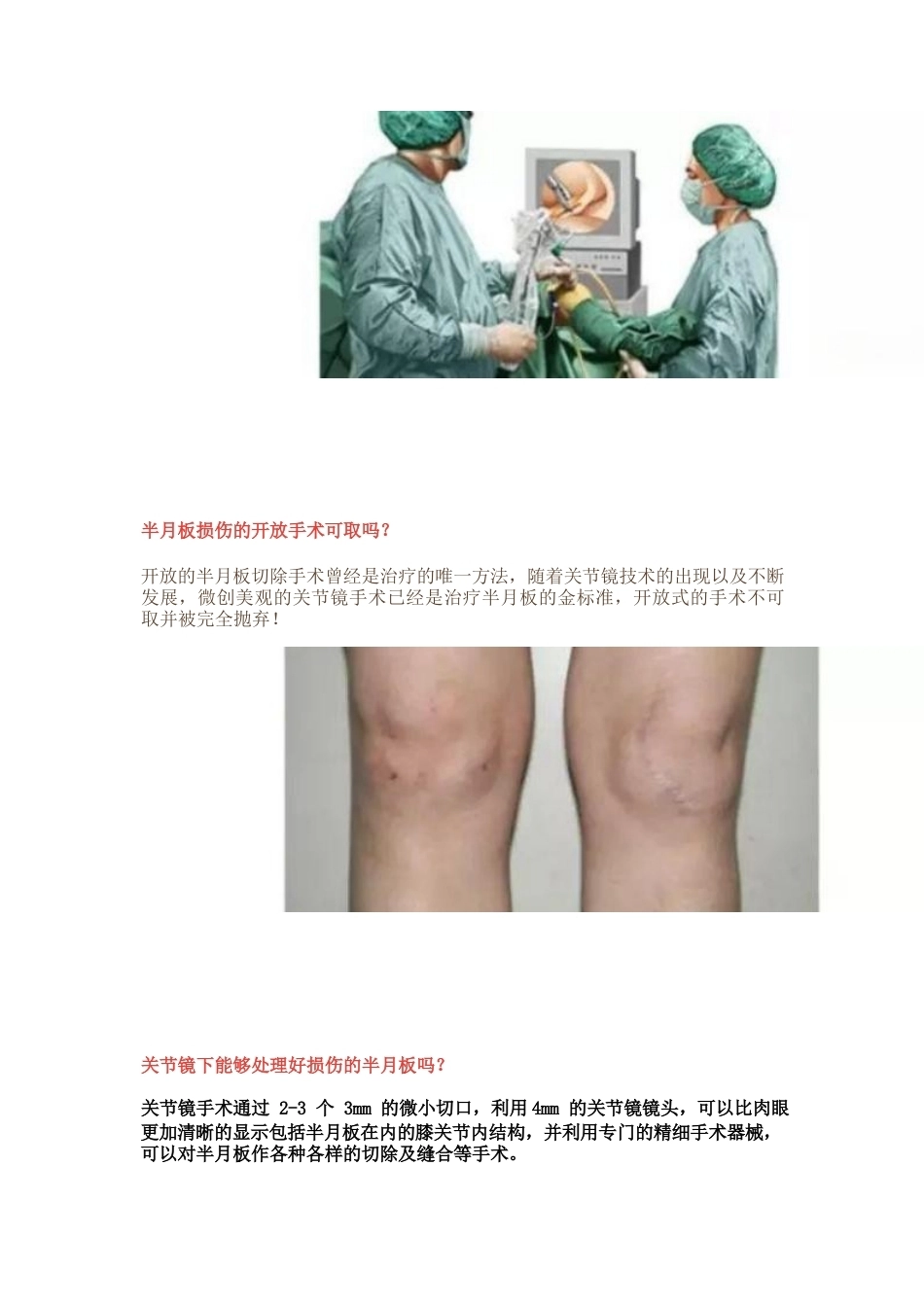 半月板损伤的治 疗技巧_第10页